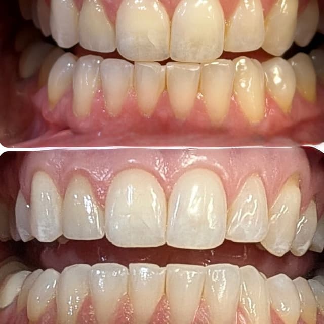 Teeth Whitening at The Glow Studio in Sioux Falls, SD